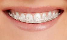 Cargar imagen en el visor de la galería, Brackets Empower Clear Individuales